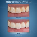 Whitening Tablets - 30pk